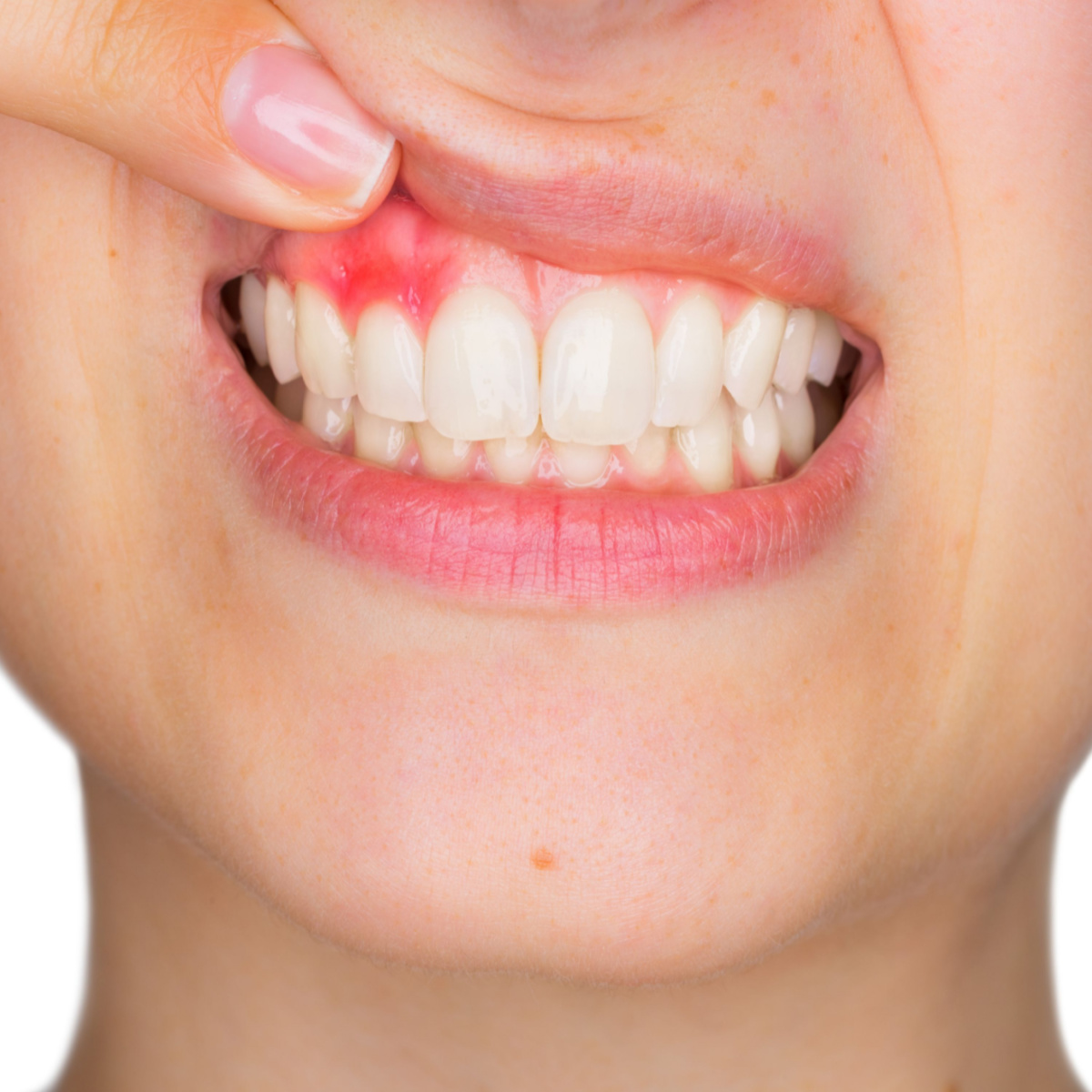 Say Goodbye to Toothaches in Just 3 Seconds: Home Remedies for Permanent Relief